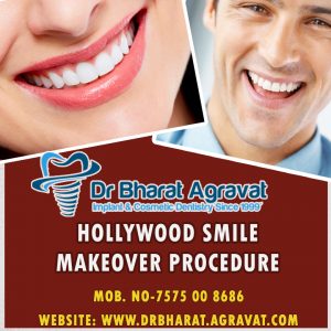 Hollywood Smile Makeover Cost in Ahmedabad India
