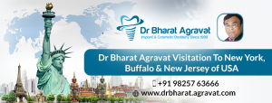 cosmetic implants dentist usa Best Cosmetic Dental Implants Ahmedabad Inida Dr. Bharat Agravat
