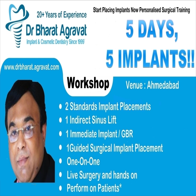 5 Days 5 Dental Implants Course workshop Gujarat India Dr Bharat Agravat
