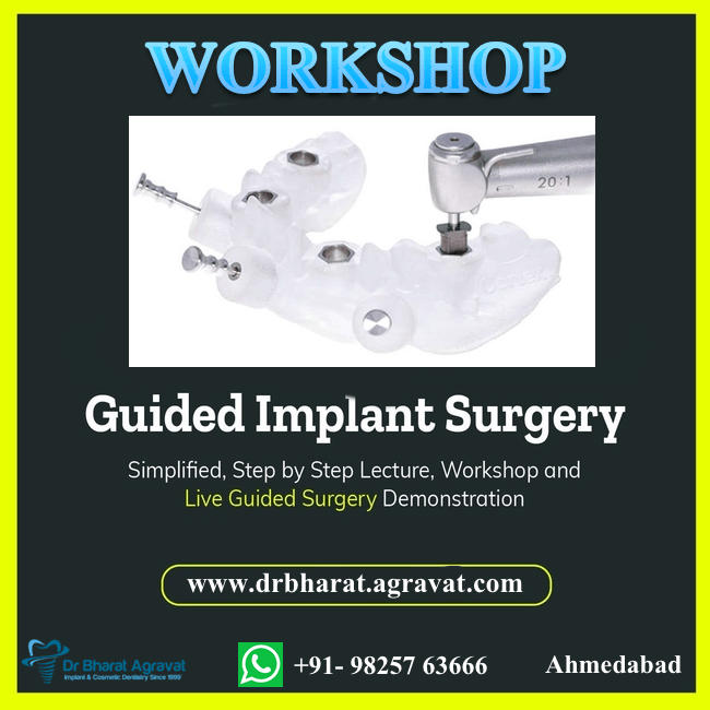 Computer Guided Implant Surgery Course Ahmedabad Gujarat India Workshop by Dr Bharat Agravat