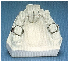 Habit Breaking Fixed appliance Dental Clinic Ahmedabad Inida