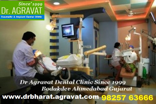 How to contact Best Implants dentist dental clinic in Ahmadabad india