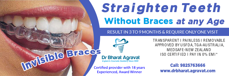 invisible braces for teeth cost price reviews in ahmedabad gujarat India