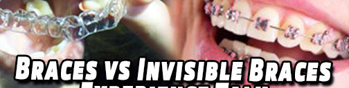 Braces vs Invisalign Video reviews ahmedabad gujarat india dr bharat agravat