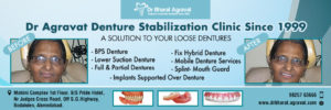 dentures cost in ahmedabad gujarat india