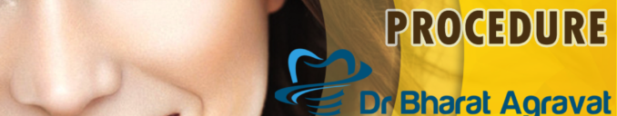 Hollywood Smile Procedure in India by Dr. Bharat Agravat the cosmetic dentist Ahmedabad