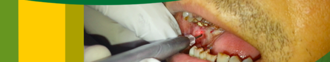 Mouth open treatment in Ahmedabad, India