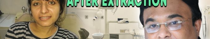 Immediate Implant Placement After Extraction A patient review of Dr Bharat Agravat Cosmetic Implants Dentist Ahmedabad, India this video demonstrate a case and video testimonial of patient who have undergone extraction of infected root piece teeth and followed by same day immediate placement of dental implant. Dental crown on Dental implants after 3 months.