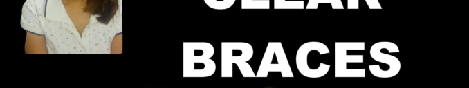 Invisalign Clear Braces Reviews On Cost, Pros & Cons, Experience, Before & After in Ahmedabad Gujarat India