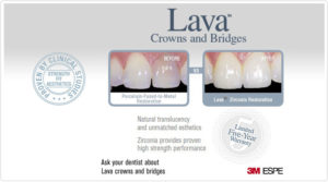 zirconia ceramic dental bridge cost in ahmedabad gujarat india
