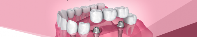 ongc panel dentist in ahmedabad gujarat india