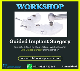 Computer Guided Implants Surgery
