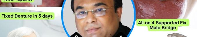 Best Dentist for Full Mouth Dental Implants Clinic in Ahmedabad Dr. Bharat Agravat, the top Implantologist.