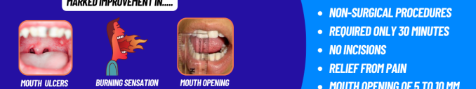 OLI Therapy OSMF Mouth Opening Treatment without Surgery