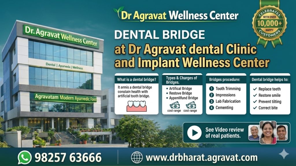 Dental Bridge Dr Bharat Agravat Dental Clinic and Implant Wellness Center Ahmedabad, Gujarat, india